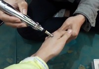 Chóng mặt, đau cơ vì ‘bút thần’ dò huyệt