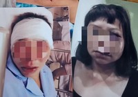 Khởi tố vụ án chồng đánh vợ dã man ở Quảng Ninh