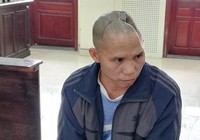 Bị mất nửa hộp sọ vẫn lãnh án về tội giết người