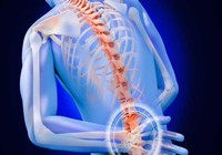 Coi chừng tàn phế vì coi thường đau lưng