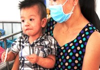 Tất tần tật cách phòng và chăm sóc bệnh sởi