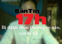 Bản tin 17h: Bị đánh chấn thương sọ não còn bị tội