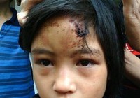 Audio: Giải cứu bé gái bị nhốt trong chùa