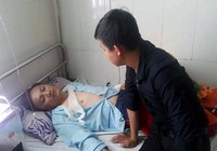 Tài xế đánh gãy tay cảnh sát giao thông rồi bỏ trốn