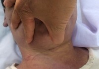 Nghi can chết bất thường ở trung tâm cai nghiện