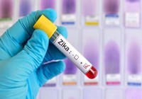 Phát hiện ca nhiễm virus Zika đầu tiên ở Vĩnh Long