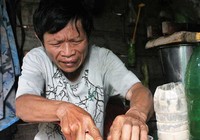 Hồi ức bị nhục hình của người tù oan