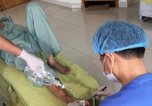 Bị hoại tử hết chân vì 17 năm mắc đái tháo đường