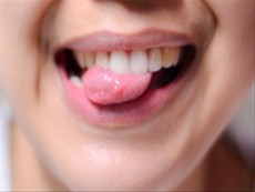 Kiểm tra lưỡi để biết bạn đang mắc bệnh gì