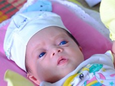 Lý giải căn bệnh kỳ lạ của 'thiên thần mắt xanh'