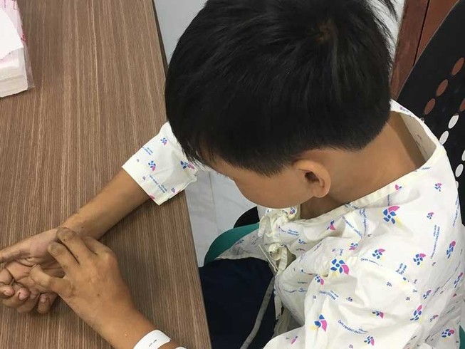 Lời dọa nạt của người lớn và chai thuốc diệt cỏ