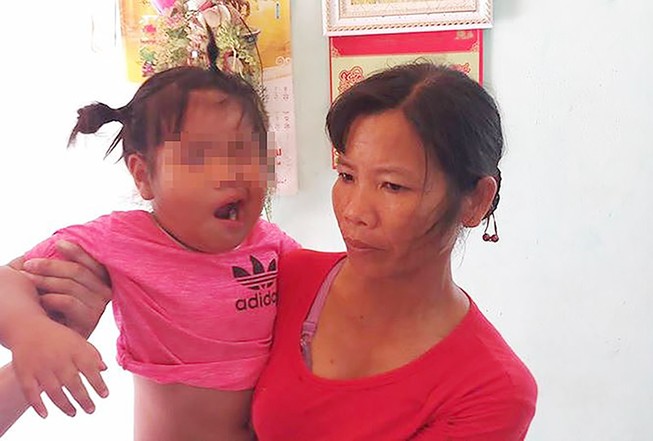 1 cô giáo bị tố đánh cháu bé 3 tuổi méo miệng