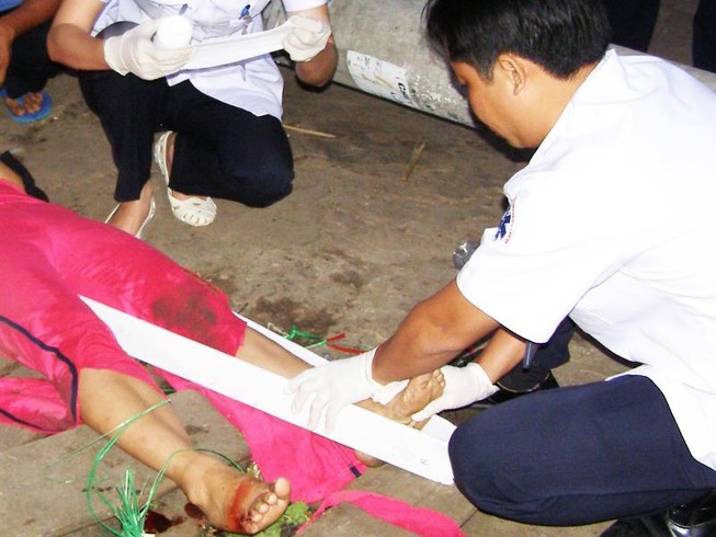 Sơ cứu tai nạn thường gặp khi đi du lịch ngày tết