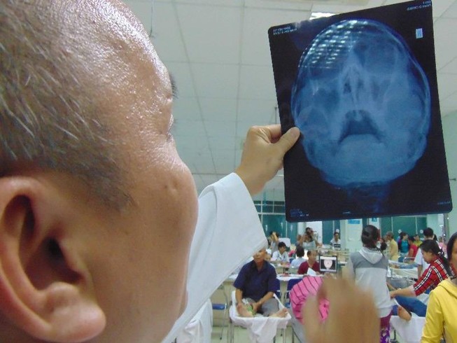 Những tai nạn từ trên trời… giáng xuống
