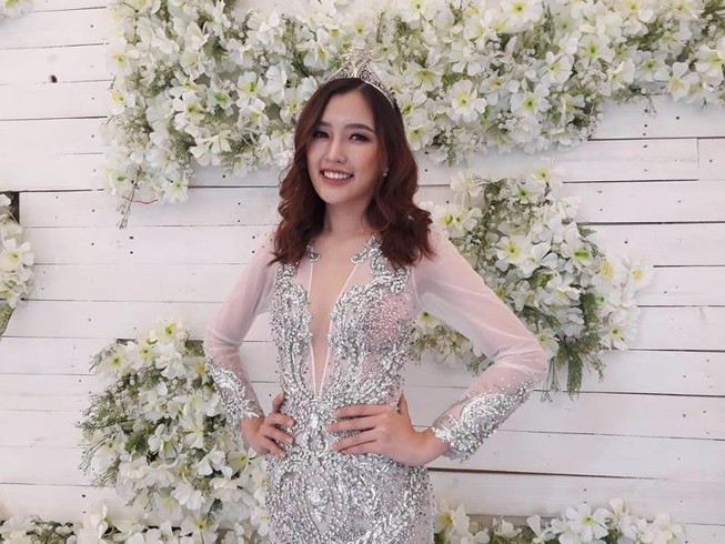 Nữ hoàng trang sức cho phép 'dao kéo' có đúng quy định