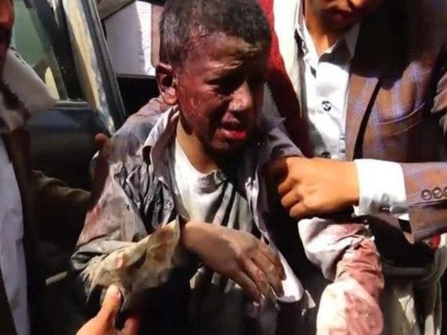 Vũ khí Mỹ và mạng người Yemen