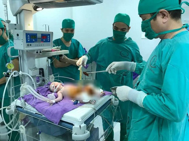 Cấp cứu trả tạng thoát vị rốn vào ổ bụng cho bé mới sinh