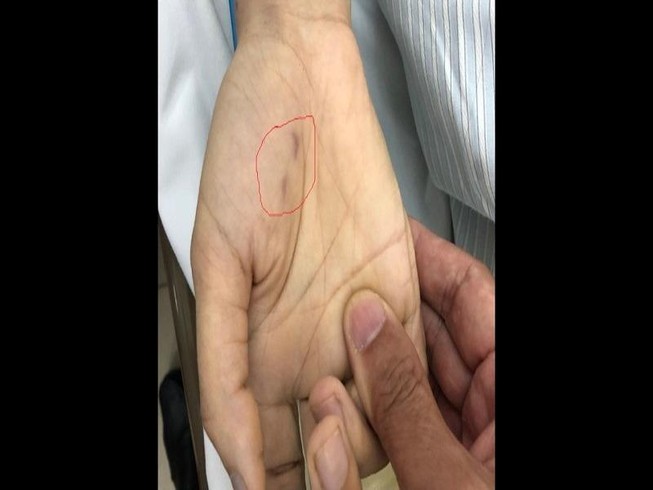 Hi hữu: Bác sĩ thú y tử vong tức tưởi vì bị chó cắn
