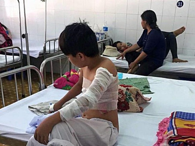 Cha phóng hỏa, 2 mẹ con nhập viện vì bỏng