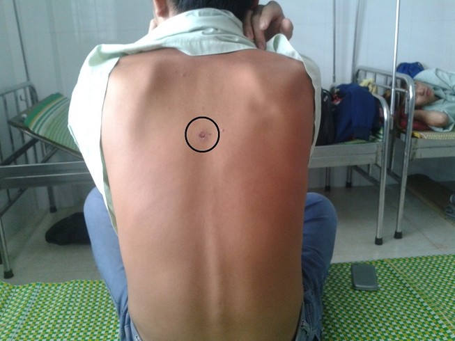 Trưởng công an xã bị tố bắn, đánh dân nhập viện