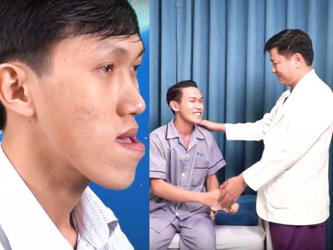 Chàng trai từ ‘mặt quỷ’ thành ‘soái ca’