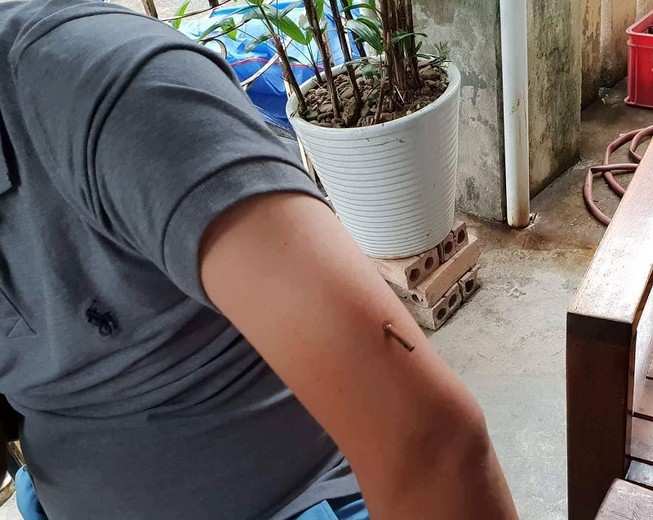 Nghi can bắn người trước quán cà phê bị bắt