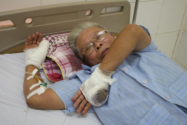 Nghi án bị chém đứt ngón tay vì tố cáo tiêu cực