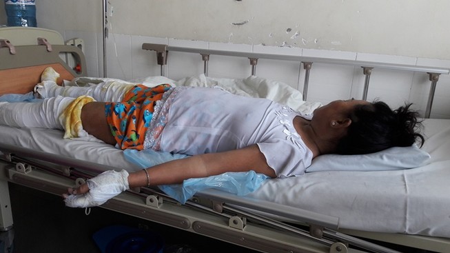 Tưới xăng đốt người tình, 1 người chết, 2 bị thương