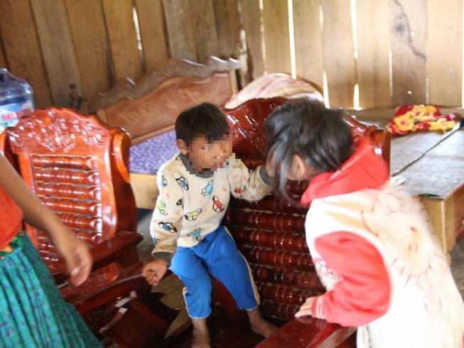 Phát hiện thêm 2 trường hợp bị chứng đầu nhỏ