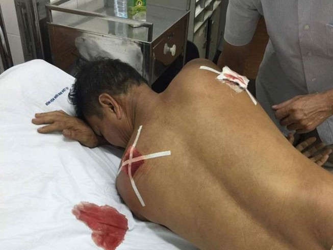 Bị chém trọng thương vì qua... nhắc nhở hàng xóm