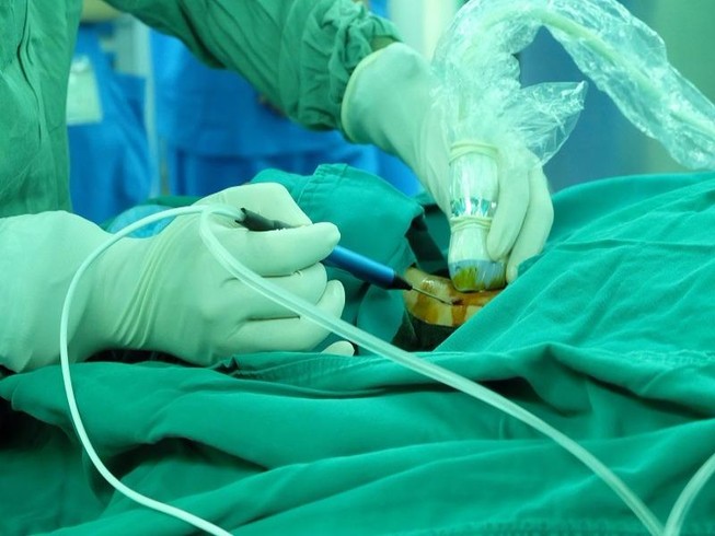 Phương pháp mới điều trị bướu cổ không cần phẫu thuật