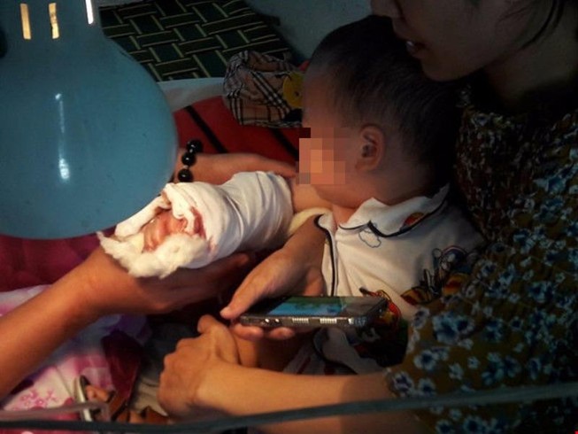 Thông tin mới vụ bé trai bị thang cuốn kéo đứt cổ tay