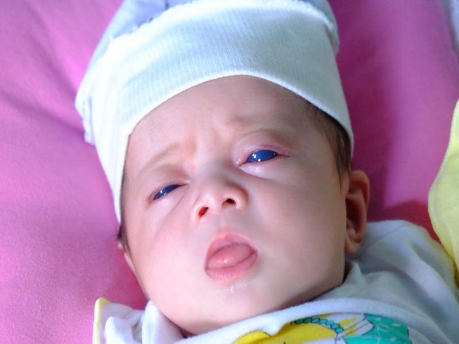 'Thiên thần mắt xanh' kỳ lạ chào đời ở Đồng Nai