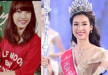 Tân hoa hậu bị tố phẫu thuật thẩm mỹ răng, ban tổ chức nói gì?