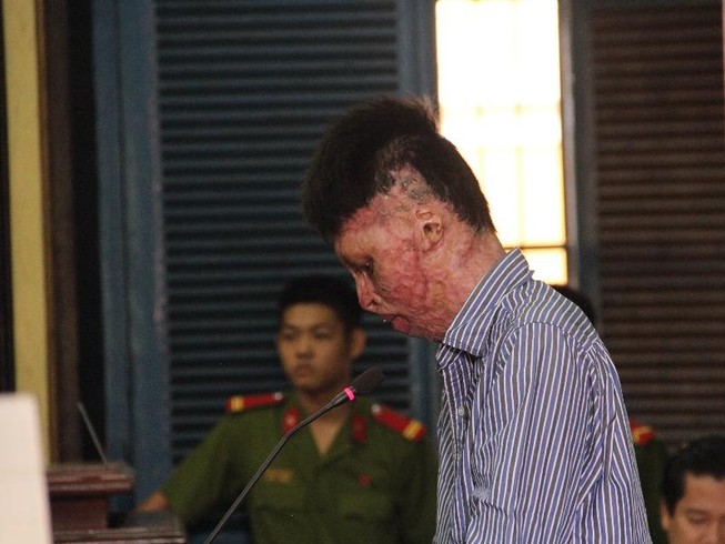 Bị bỏng nặng, vẫn phải ra tòa vì đốt chết người yêu