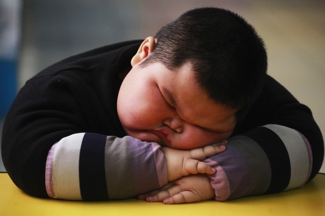 Nửa số trẻ béo phì toàn cầu là ở châu Á