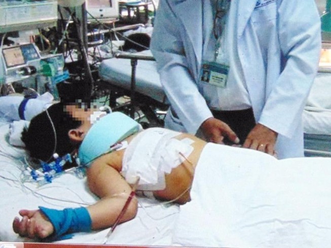 Cứu sống bé trai bị thanh sắt đâm xuyên từ sau ra trước