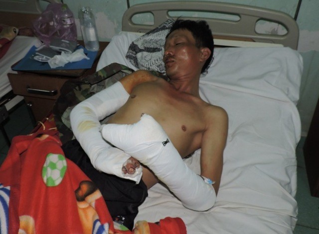 Côn đồ chém loạn xạ trong lễ tân gia, sáu người trọng thương