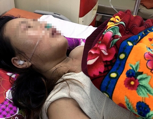 Chồng đánh vợ tổn thương sọ não, nhập viện cấp cứu