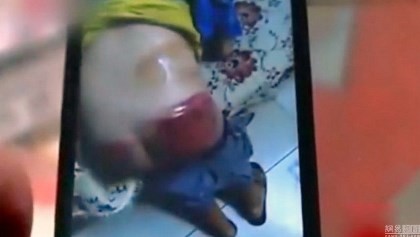 Giáo viên đánh bầm mông học sinh vì không làm bài tập về nhà