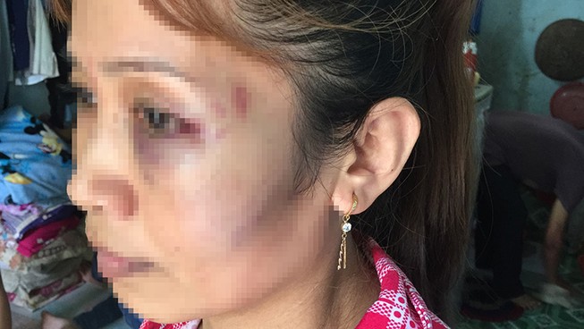 Không cho mượn phòng trọ để nhậu, cả nhà bị đánh