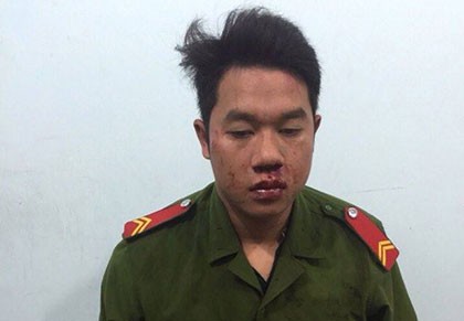 Bắt nóng 2 nghi can giả danh công an lừa đảo, cướp tài sản