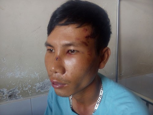 Đồng hương xử nhau vì va chạm giao thông
