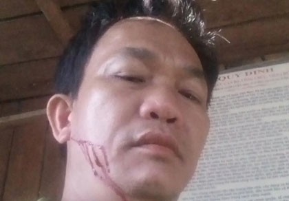 Vận chuyển gỗ lậu, còn đến trạm tấn công cán bộ kiểm lâm