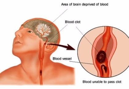 Một ngư dân tai biến tử vong trên biển