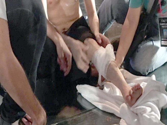 Đàm Vĩnh Hưng gặp tai nạn phải khâu 6 mũi