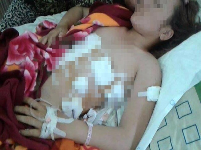 Bị người tình của chồng đâm suýt mất mạng