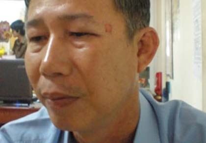Bị hành hung sau khi góp ý nhà lấn hẻm