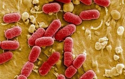 Hơn 100 công nhân bị ngộ độc: Nghi do nhiễm khuẩn E.coli