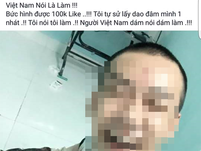 Những 'con bệnh' nghiện like tự làm lố để nổi tiếng
